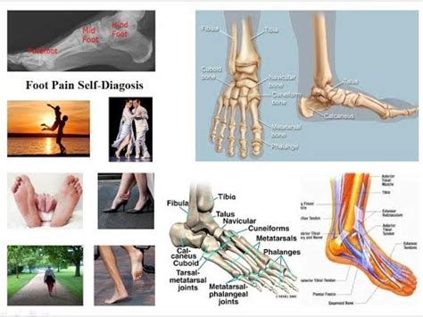 Care sunt cauzele și simptomele durerilor articulare și cum se tratează acestea (P)